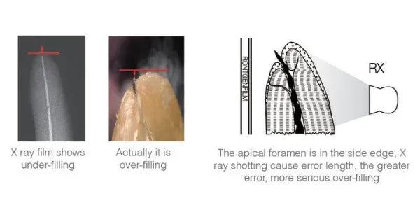 Accurator A2 Apex Locator - Dental Equipment Store