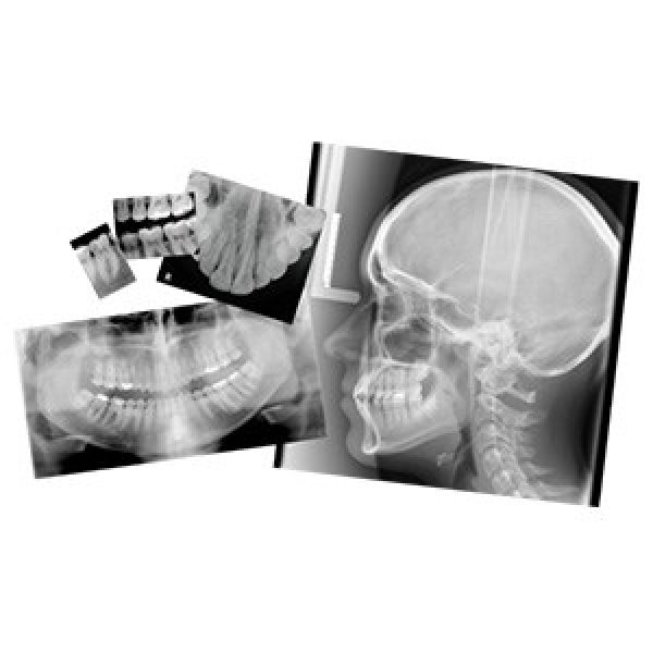 Velopex Extra-X Automatic Dental X-Ray Film Processor - Dental Equipment Store