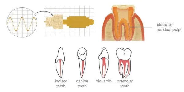 Accurator A2 Apex Locator - Dental Equipment Store