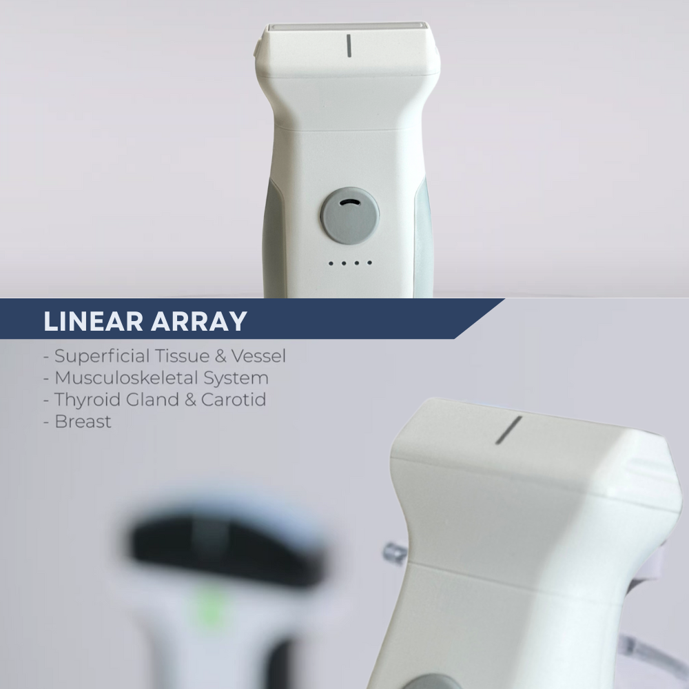 VioScan L2 – Wireless Handheld Linear Ultrasound - Dental Equipment Store