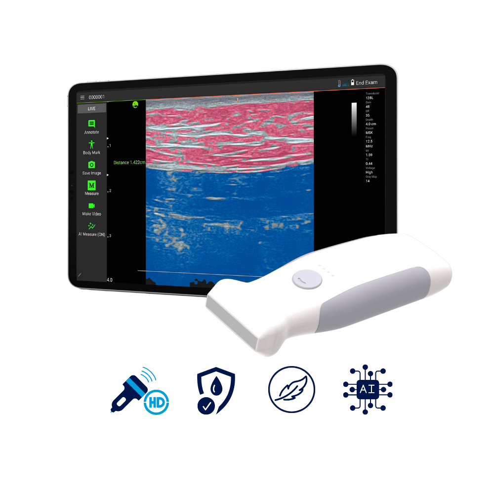 VioScan L2 – Wireless Handheld Linear Ultrasound - Dental Equipment Store