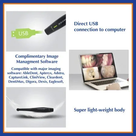 Beyes Canaview Intra Oral Camera Model EV2060 - Dental Equipment Store