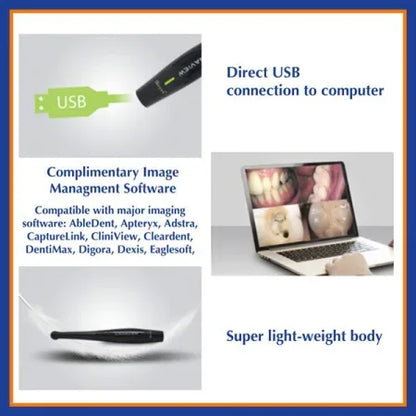 Beyes Canaview Intra Oral Camera Model EV2060 - Dental Equipment Store