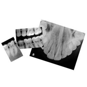 Velopex Intra X Automatic Dental X-Ray Film Processor - Dental Equipment Store