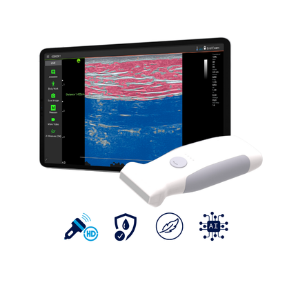 VioScan L2 – Wireless Handheld Linear Ultrasound - Dental Equipment Store