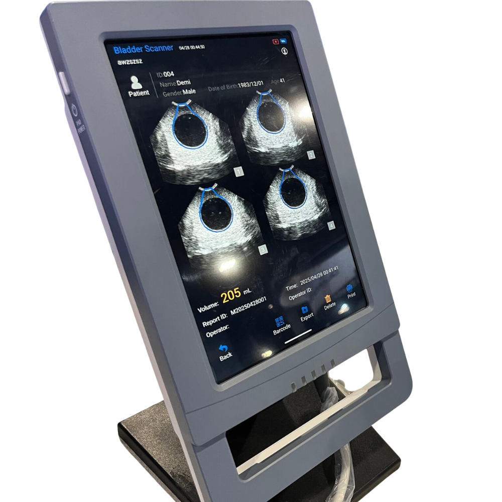 VioScan Portable Bladder Scanner - Dental Equipment Store