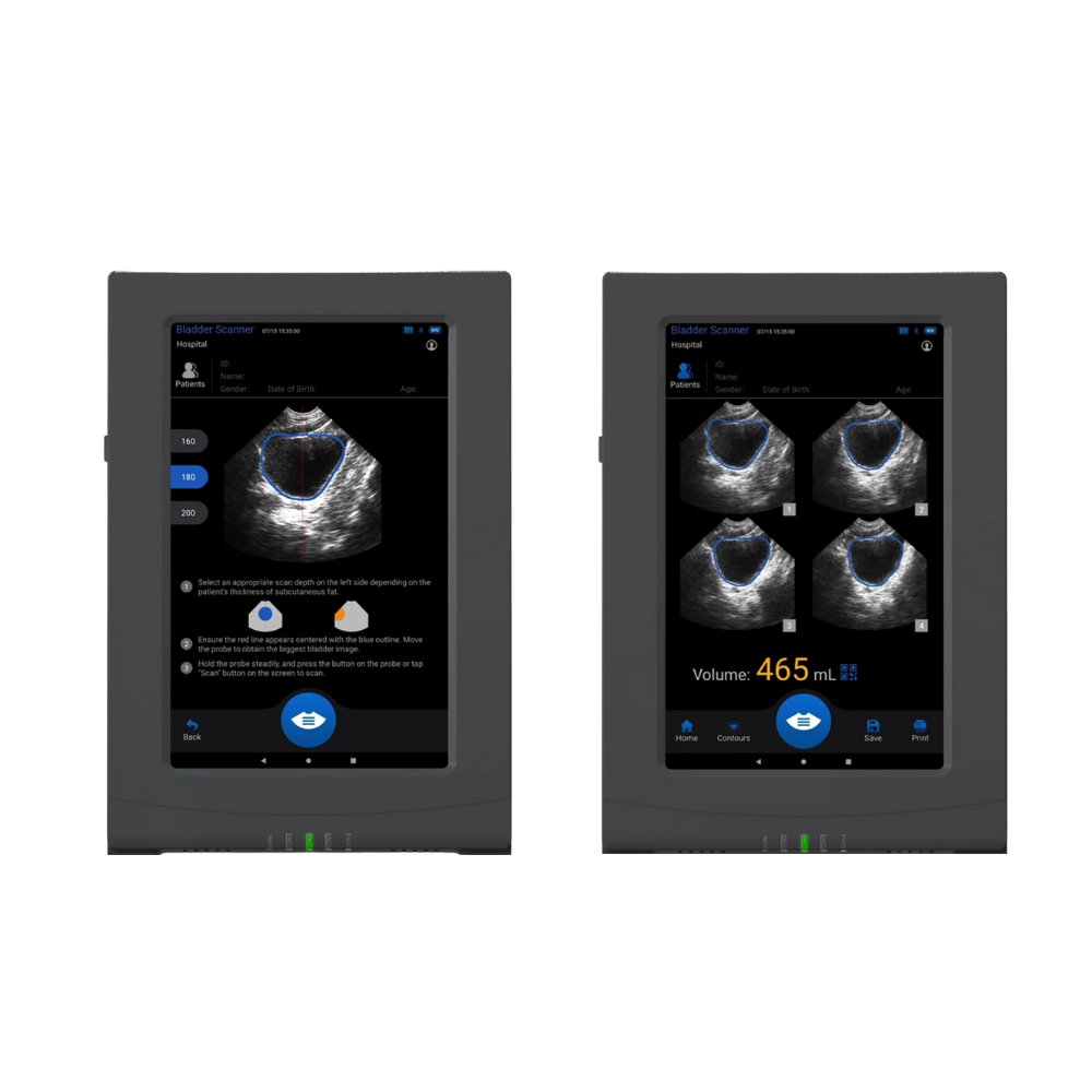 VioScan Portable Bladder Scanner - Dental Equipment Store