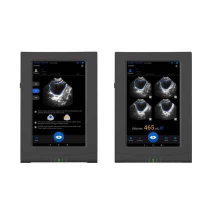 VioScan Portable Bladder Scanner - Dental Equipment Store